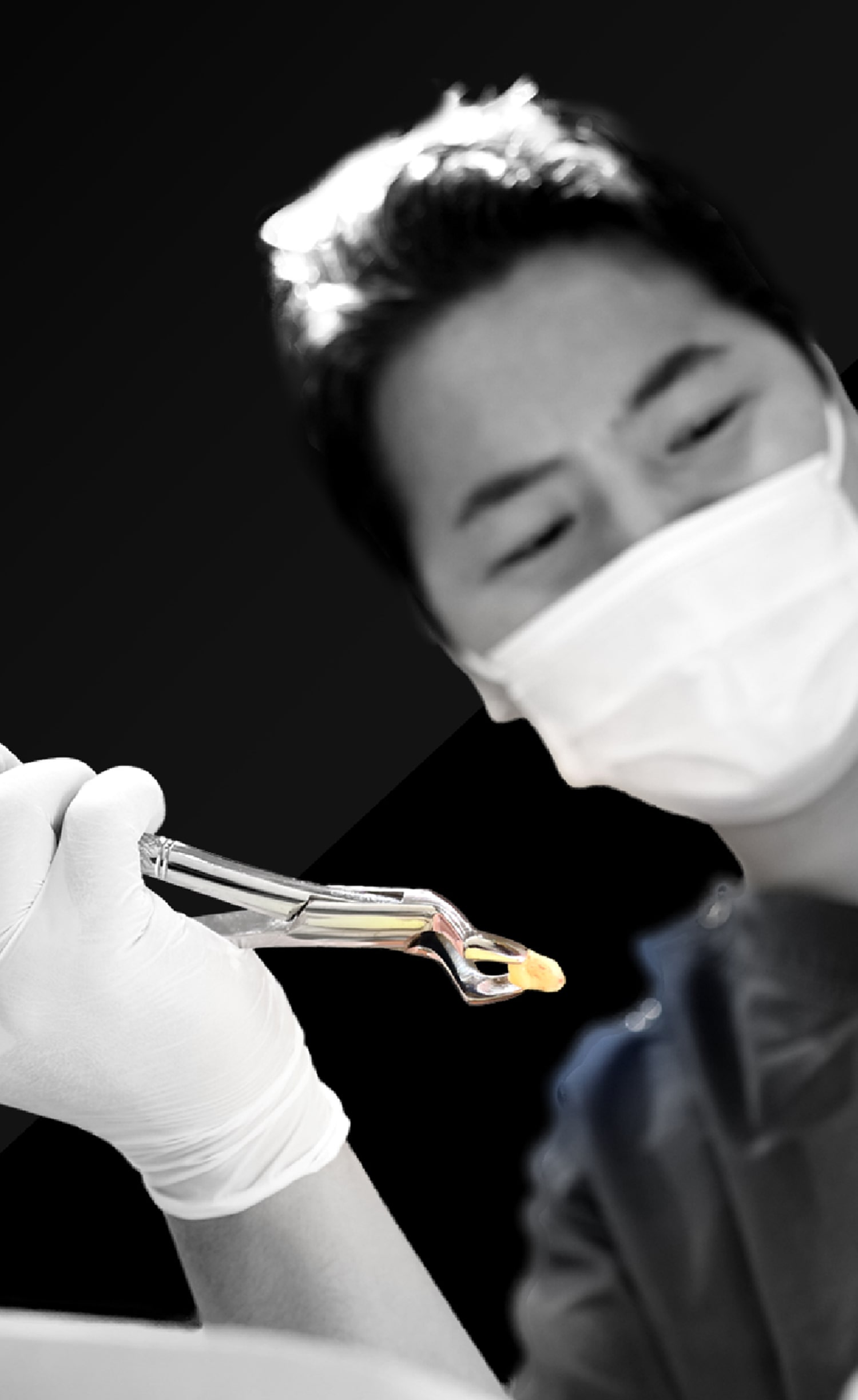 東京で親知らずを抜く 口腔外科医による抜歯情報サイト